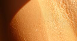 tanning damages skin barrier