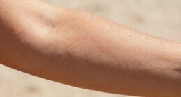 base tan isn t protection