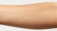 gradual skin darkening process
