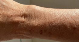 indoor tanning affects skin texture