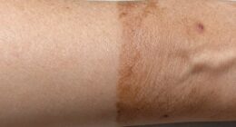 indoor tanning skin effects