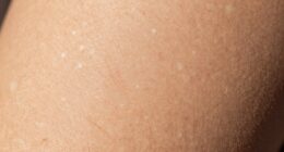 invisible early uv effects