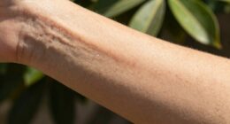 moisturize hydrate soothe protect