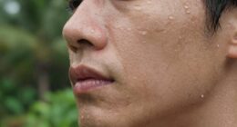 seasonal humidity impacts skin