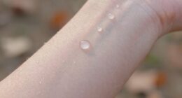 seasonal weather affects skin moisture