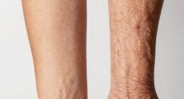 skin tone alterations over time