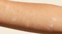 sun exposure affects tan longevity