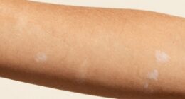sun exposure affects tan longevity