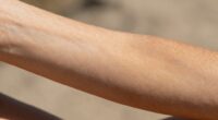 sunbed use alters skin tone