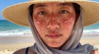 sunscreen needed daily
