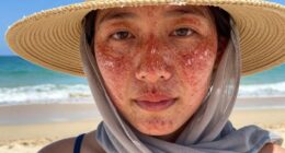 sunscreen needed daily