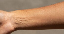 tan indicates skin health