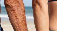 tanning harms skin health