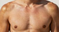 uneven tanning body areas