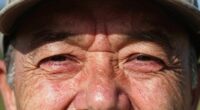uv damage impacts eyes