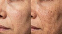 uv light accelerates skin aging