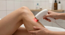 15 Best At-Home Laser Hair Removal Devices in 2026